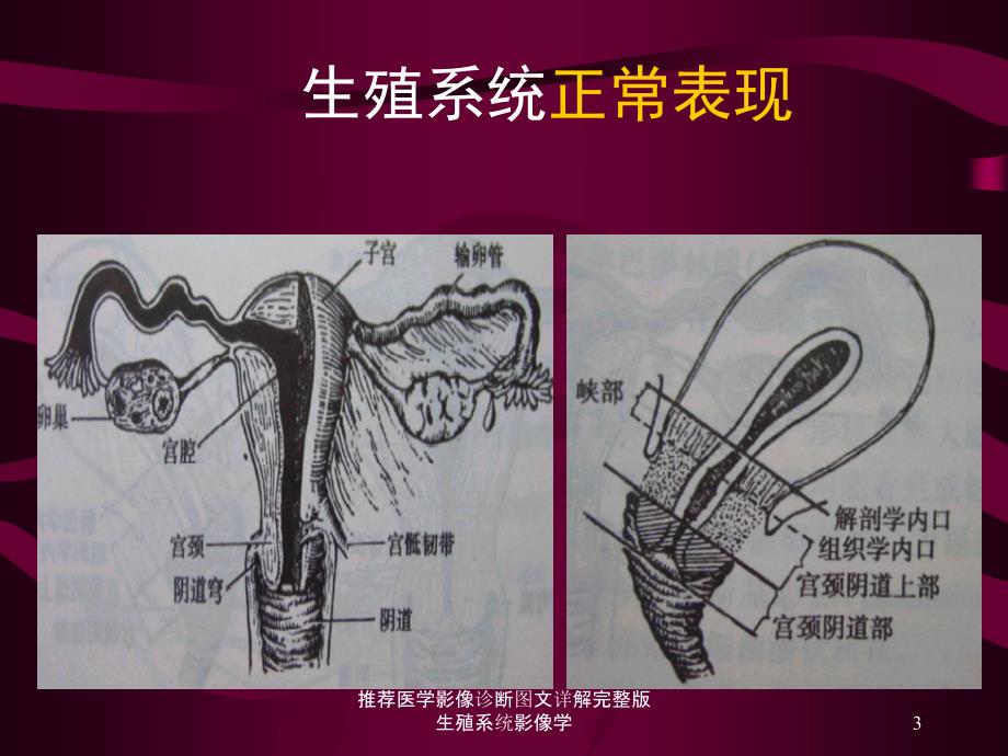 推荐医学影像诊断图文详解完整版生殖系统影像学课件_第3页