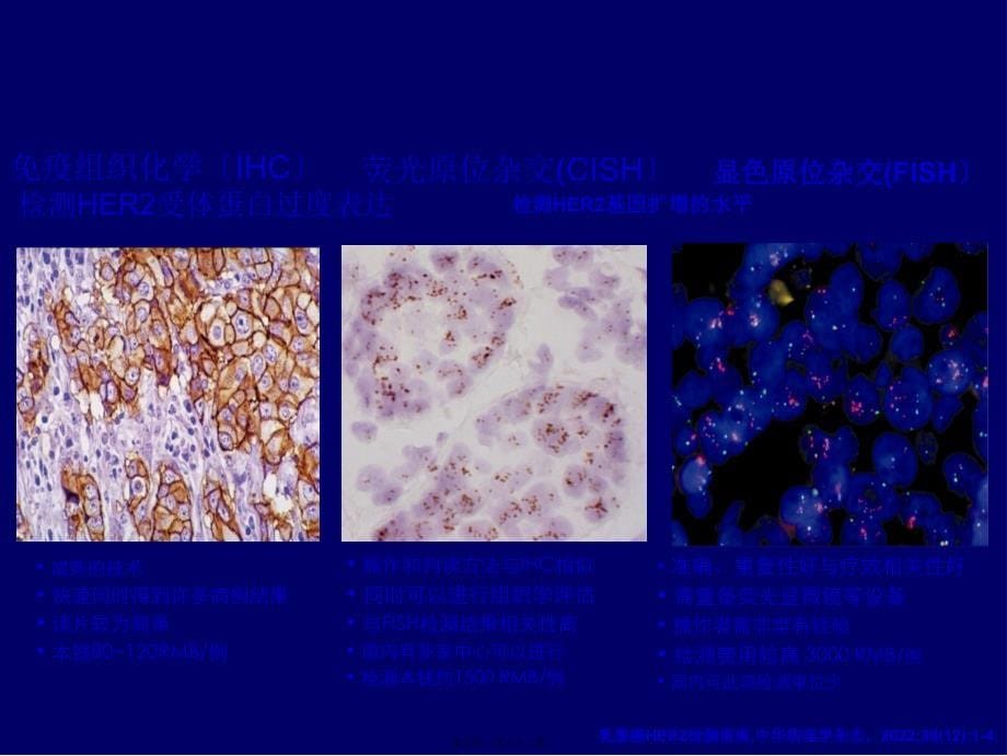 HER阳性乳腺癌诊疗专家共识_第5页