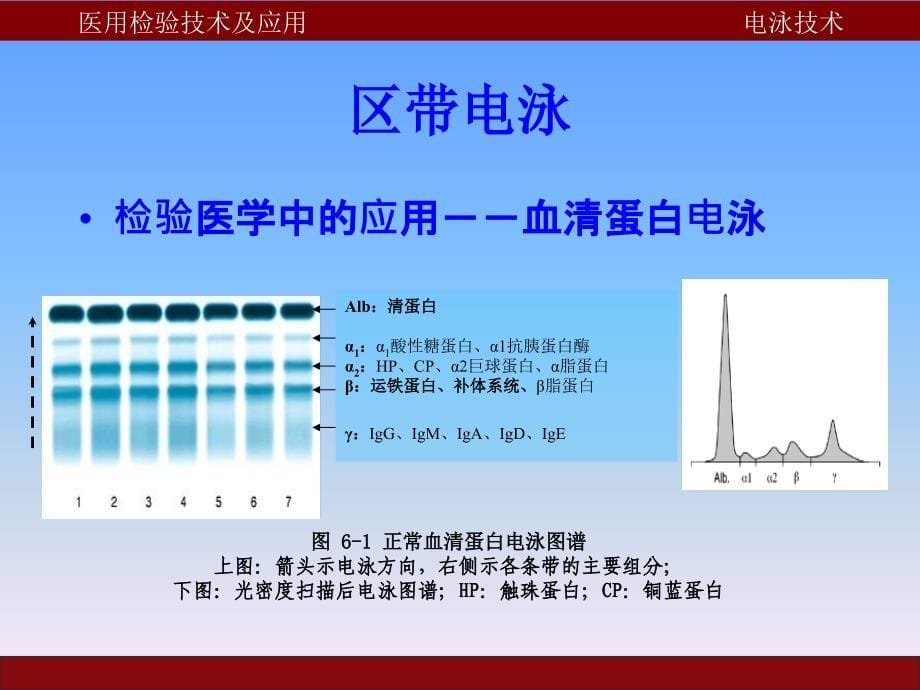 《电泳技术》PPT课件.ppt_第5页