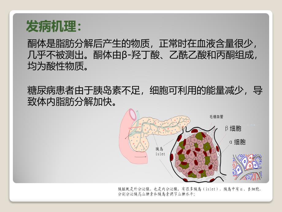 糖尿病酮症酸中毒病人护理查房_第4页