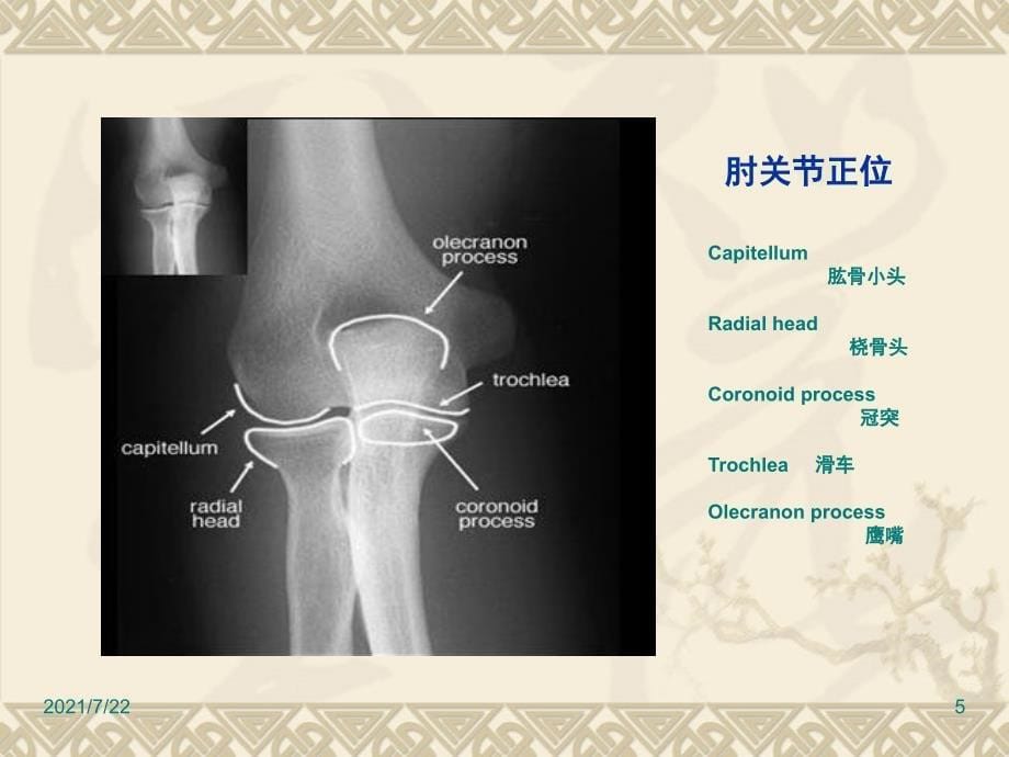 正常骨骼X线解剖PPT课件_第5页