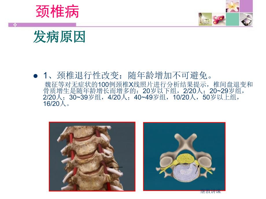 颈腰椎病的预防与自我保健PPT幻灯片课件_第2页