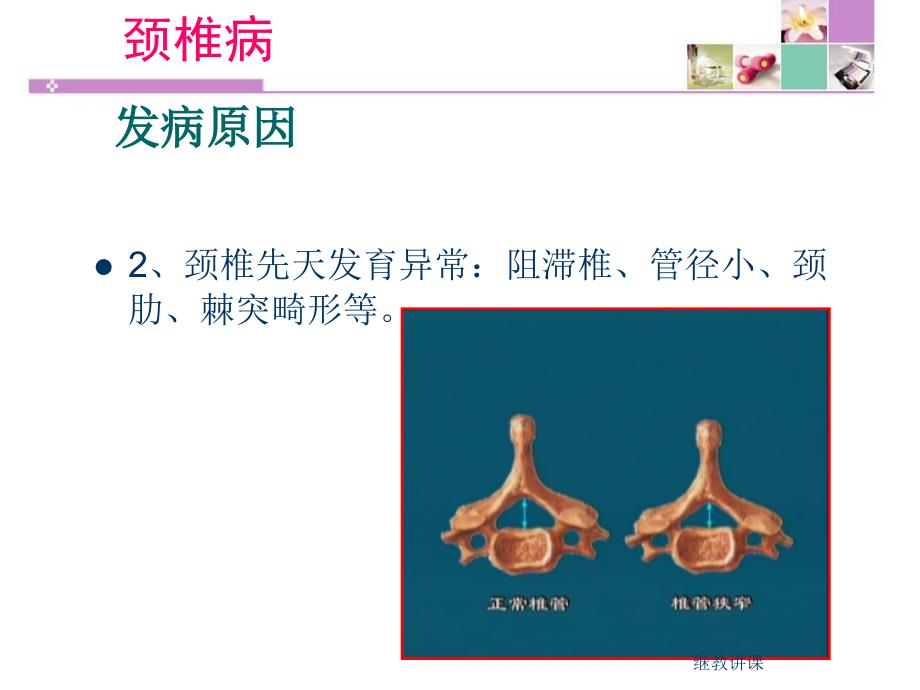 颈腰椎病的预防与自我保健PPT幻灯片课件_第3页