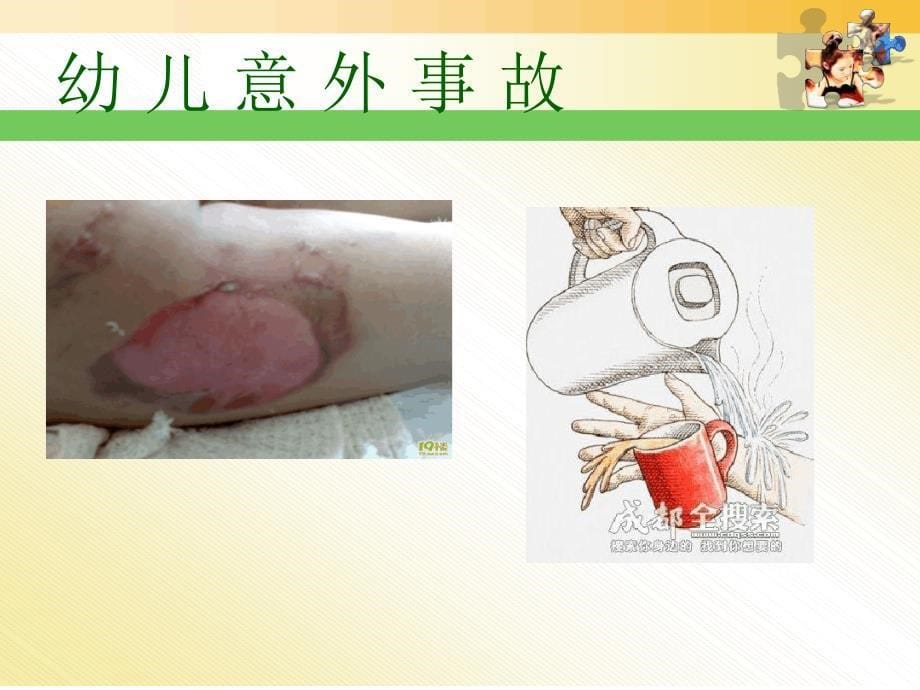 第五章学前儿童意外事故预防与处理课件_第5页