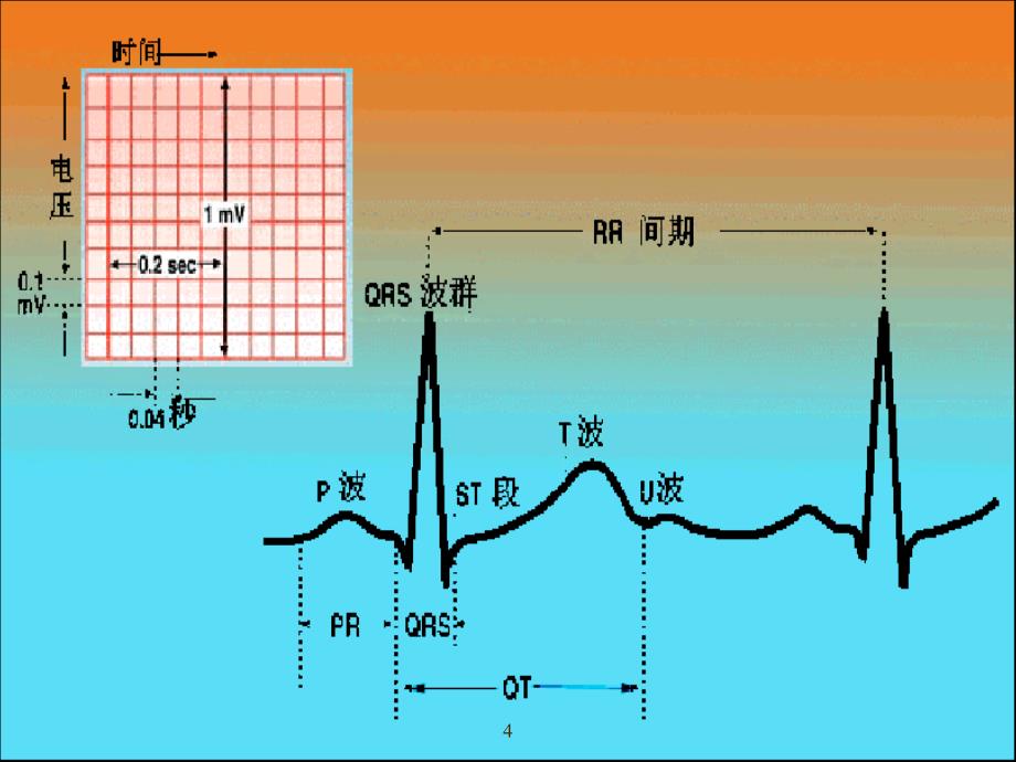 心电图讲课PPT课件_第4页