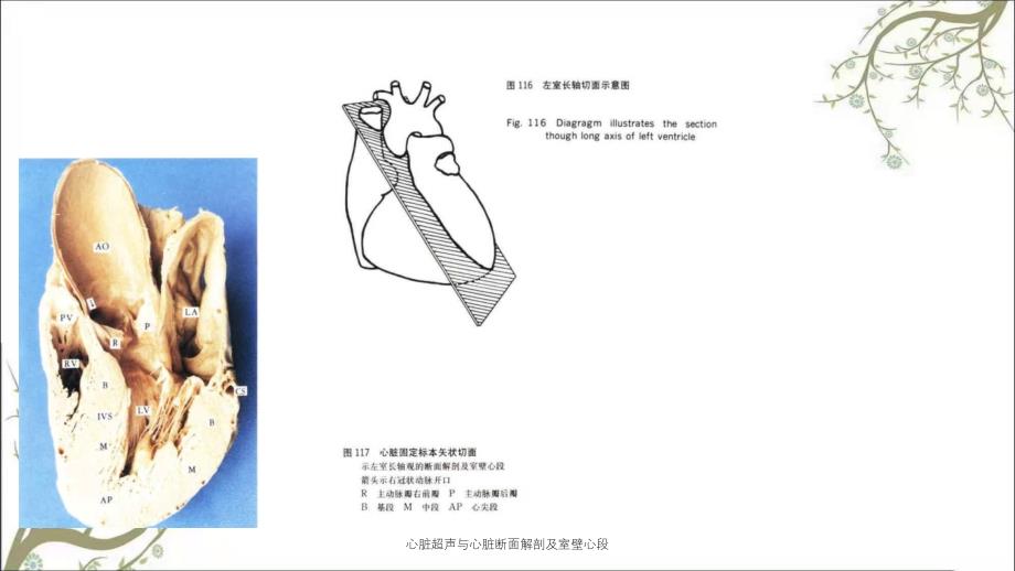 心脏超声与心脏断面解剖及室壁心段_第2页