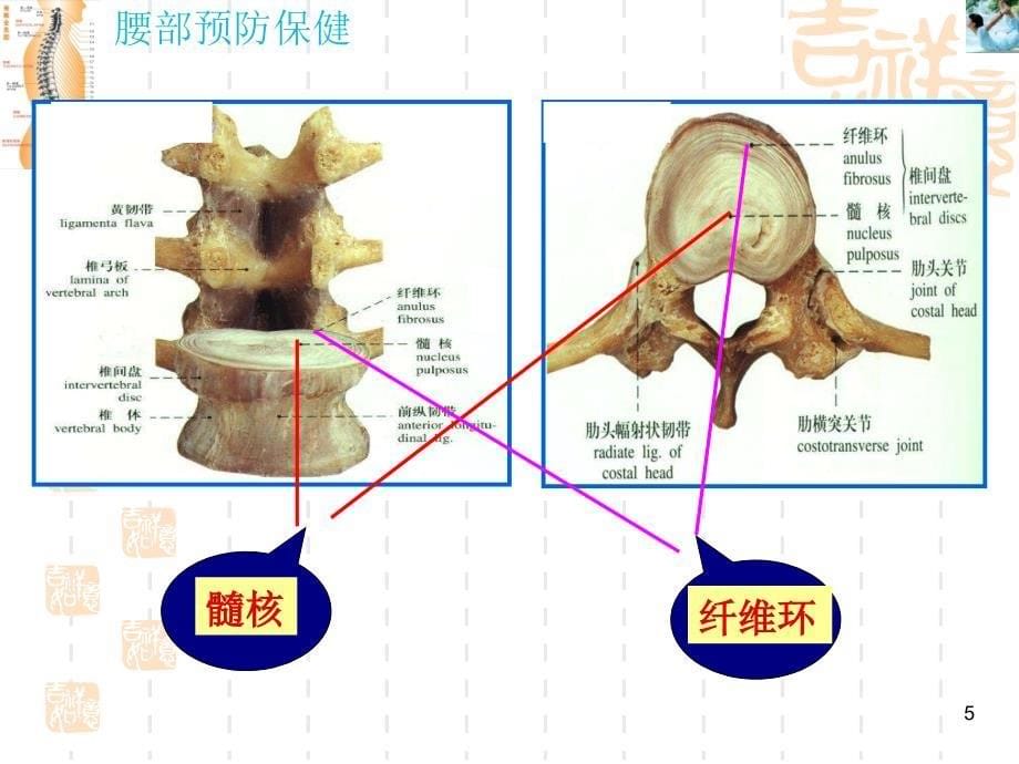 《腰部保健预防》PPT课件_第5页