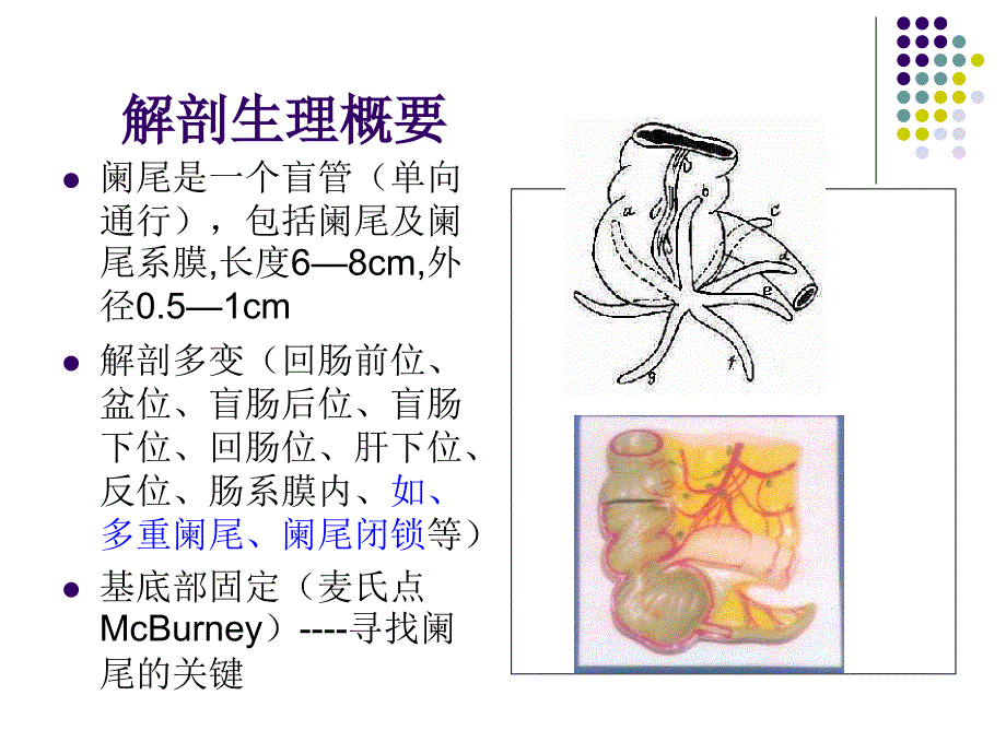 急性阑尾炎-(2)课件_第2页