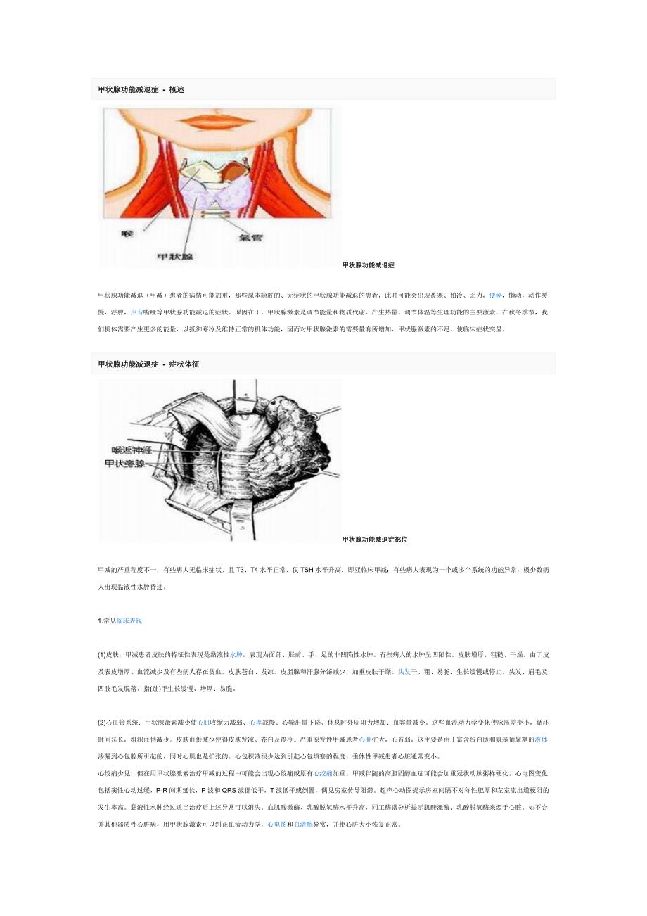 甲状腺功能减退症 - 概述.doc_第1页