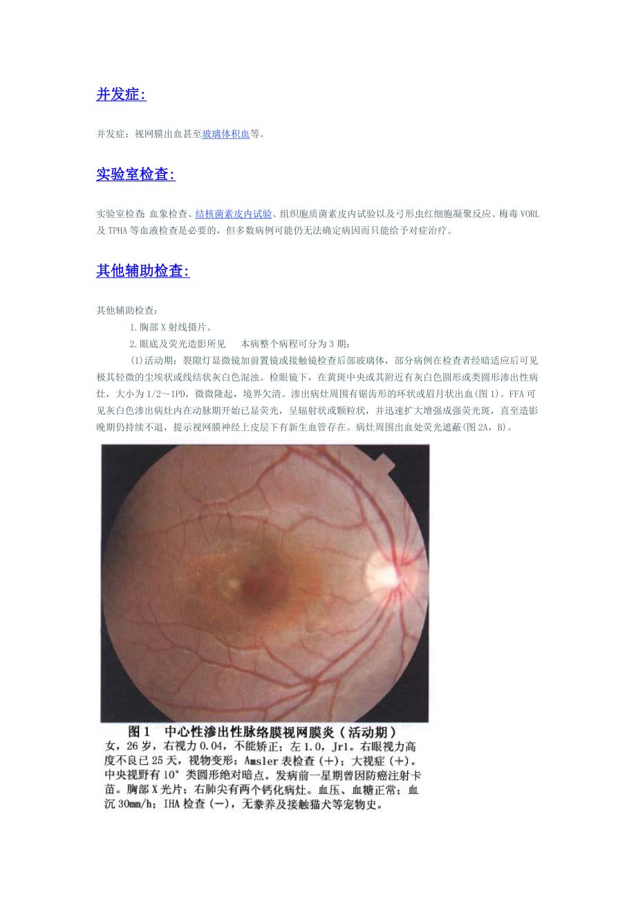 中心性渗出性脉络膜视网膜病变.doc_第2页
