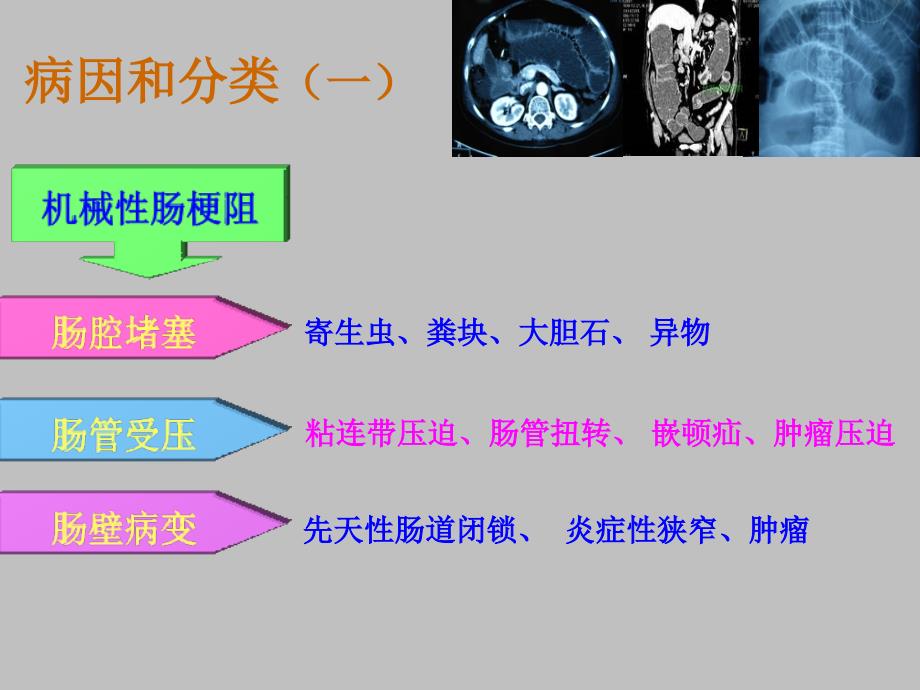 中西医结合治疗肠梗阻及循证证据_第4页