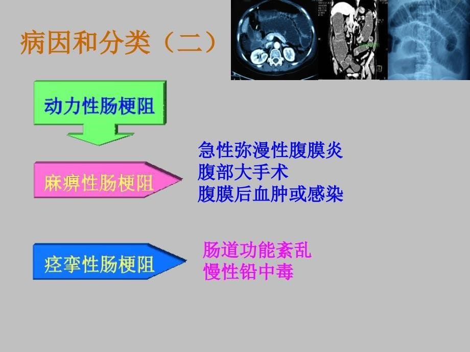 中西医结合治疗肠梗阻及循证证据_第5页