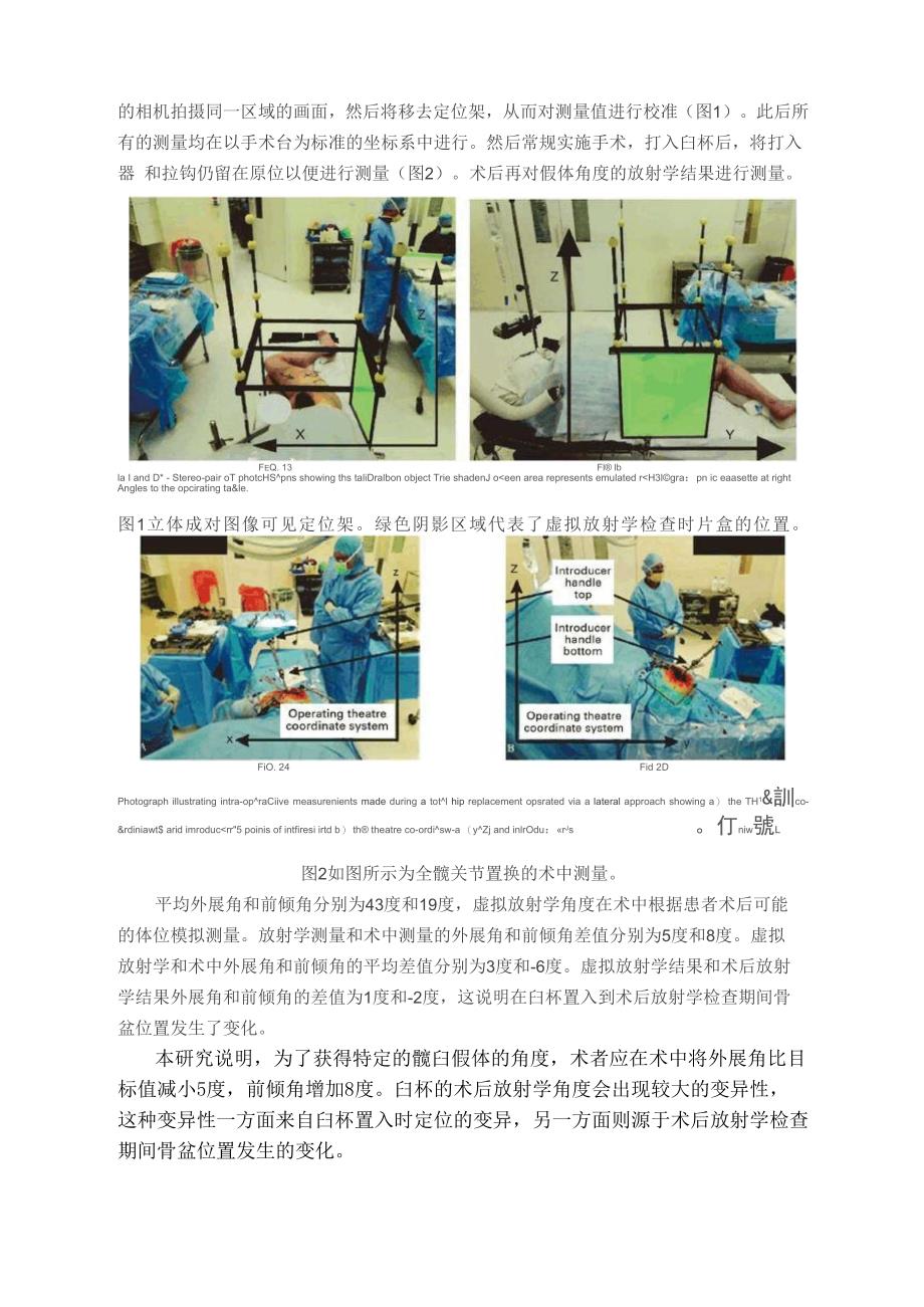 髋臼假体术中角度的定位方法_第3页