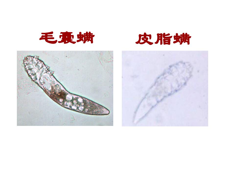 蠕形螨ppt课件_第2页