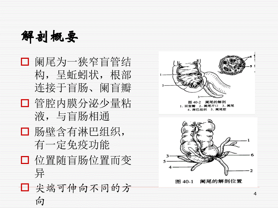 急性阑尾炎护理查房护理查房PPT课件_第4页