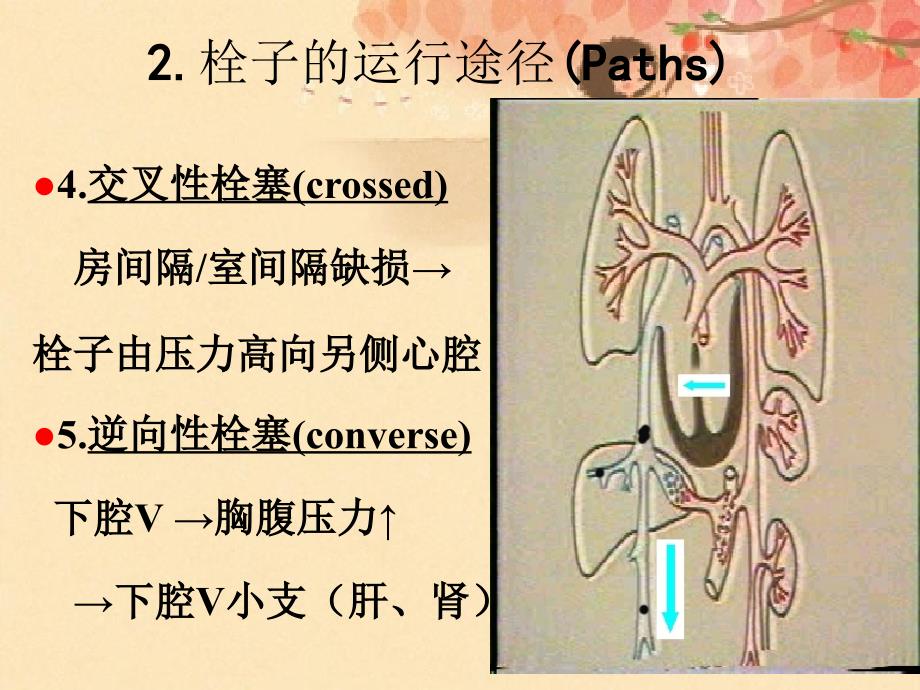 临床真题讲解课件_第4页