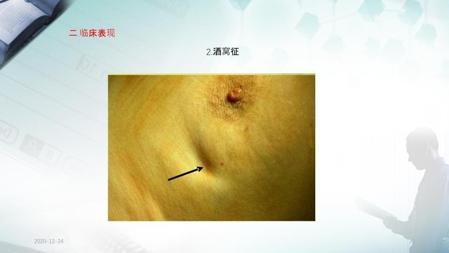 乳腺癌病人的护理实用课件_第5页