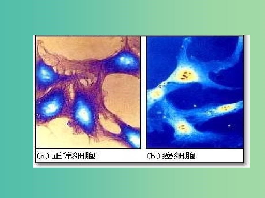 2019高中生物 专题6.4 细胞的癌变同步课件 新人教版必修1.ppt_第5页