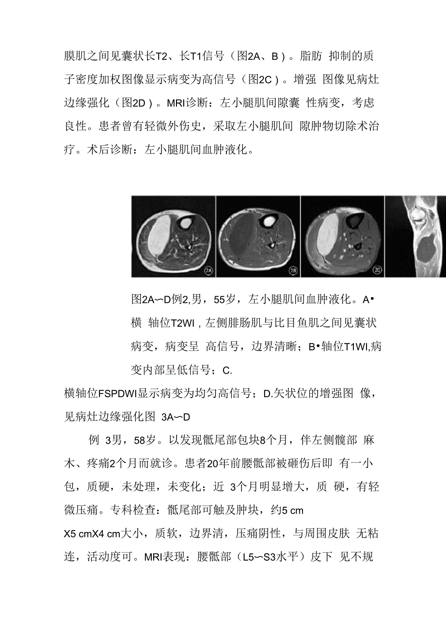 医学医学影像科晋升副主任医师病例分析专题报告_第3页