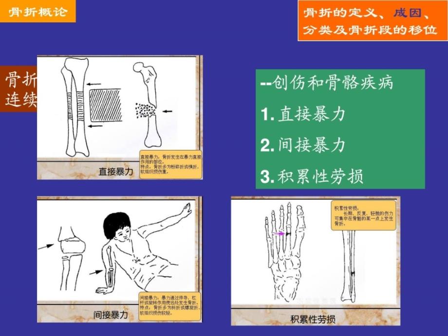 《精彩骨科泛论》PPT课件_第3页