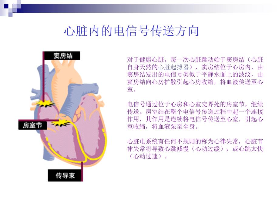 心律失常的护理查房PPT课件_第4页