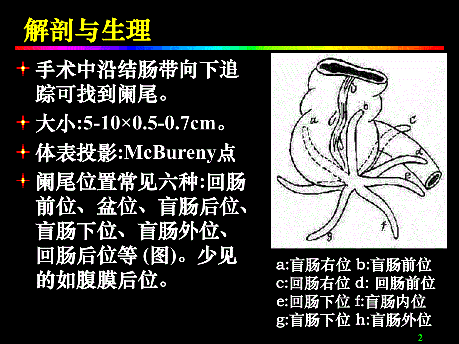 阑尾炎Acute_appendicitis_第2页