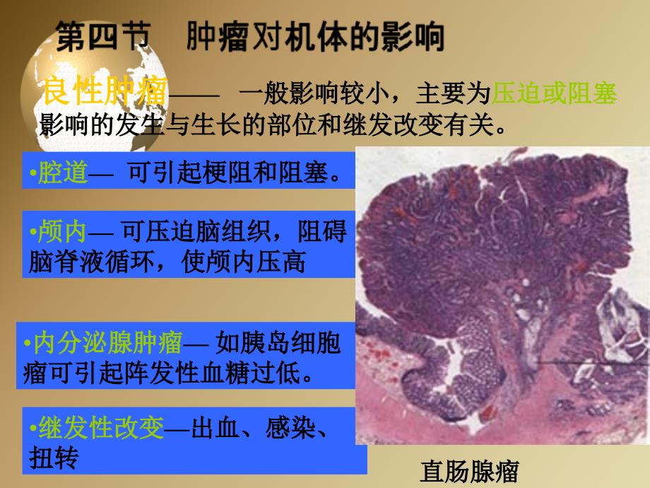 第五章肿瘤第二部分_第3页