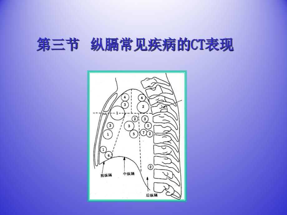 纵膈常见疾病的ct表现_第1页