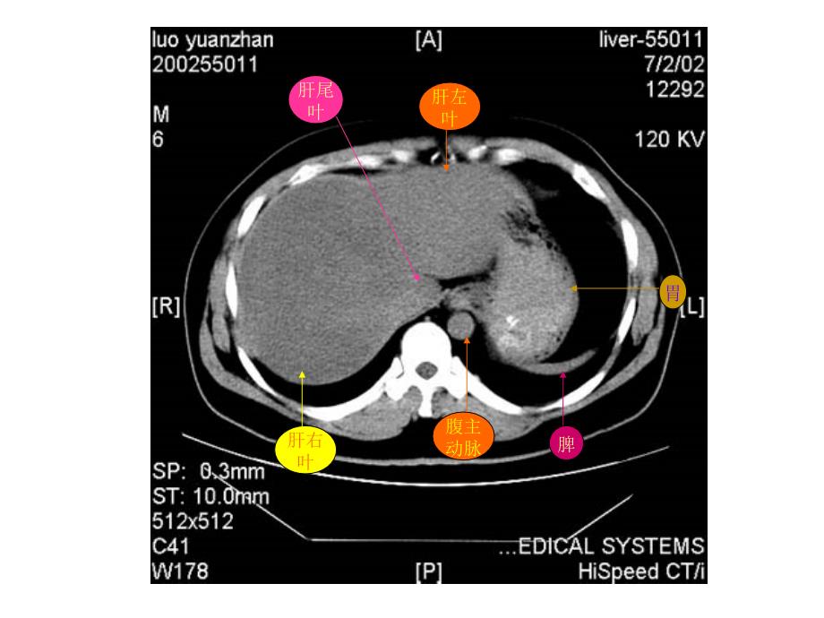《教你认识腹部CT》PPT课件_第3页