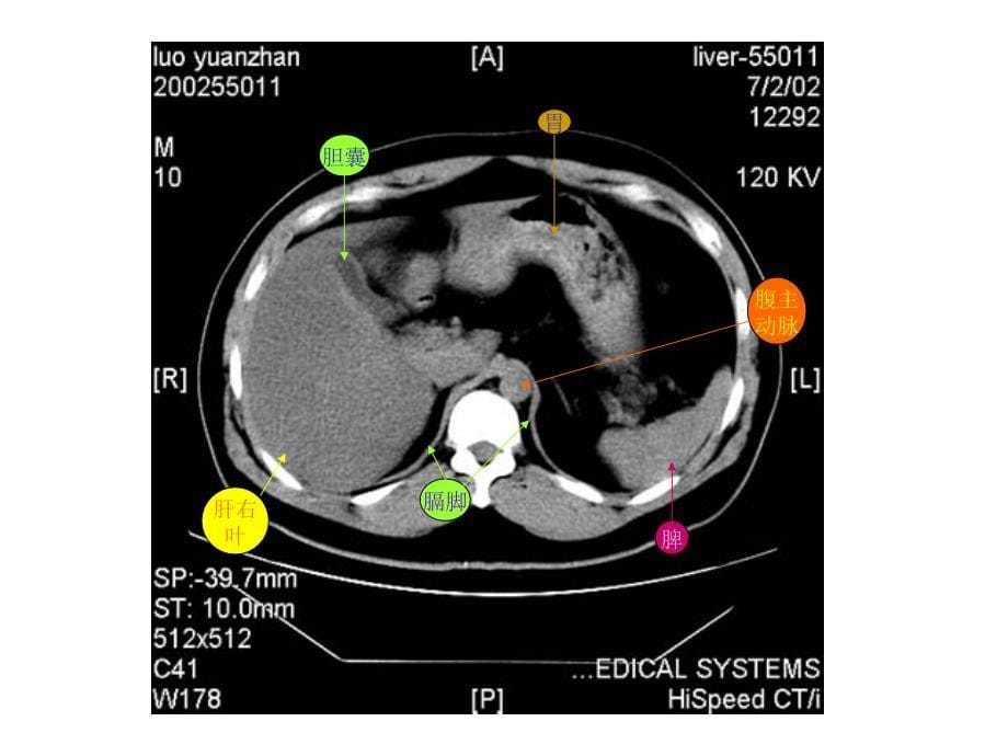 《教你认识腹部CT》PPT课件_第5页