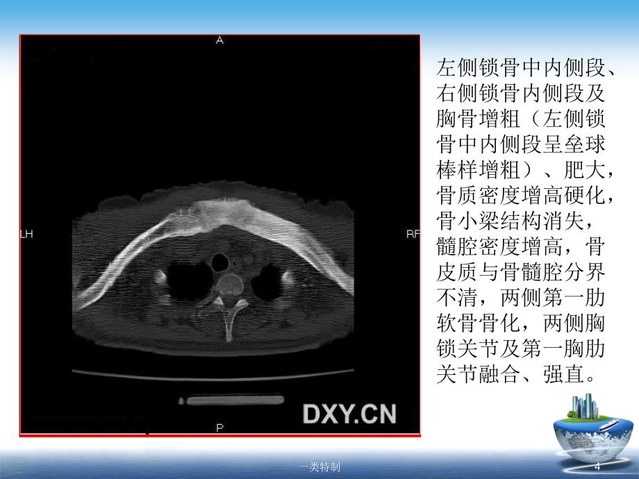 SAPHO综合征行业研究_第4页