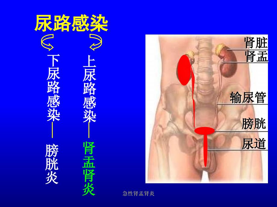 急性肾盂肾炎_第2页