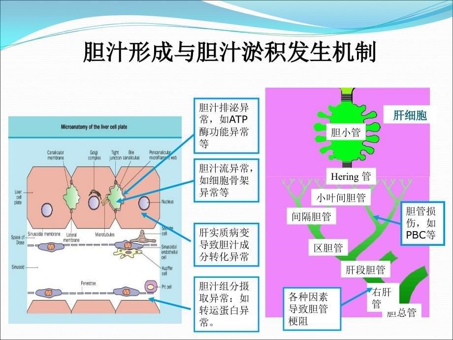 胆汁淤积性肝病治疗专家共识PPT医学课件_第5页