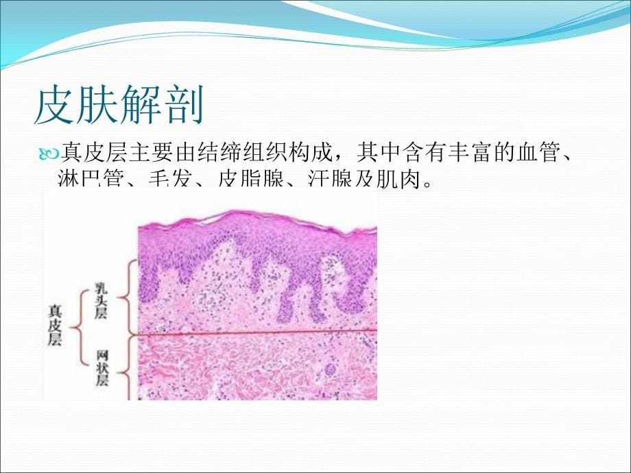 皮肤疾病的超声诊断_第5页