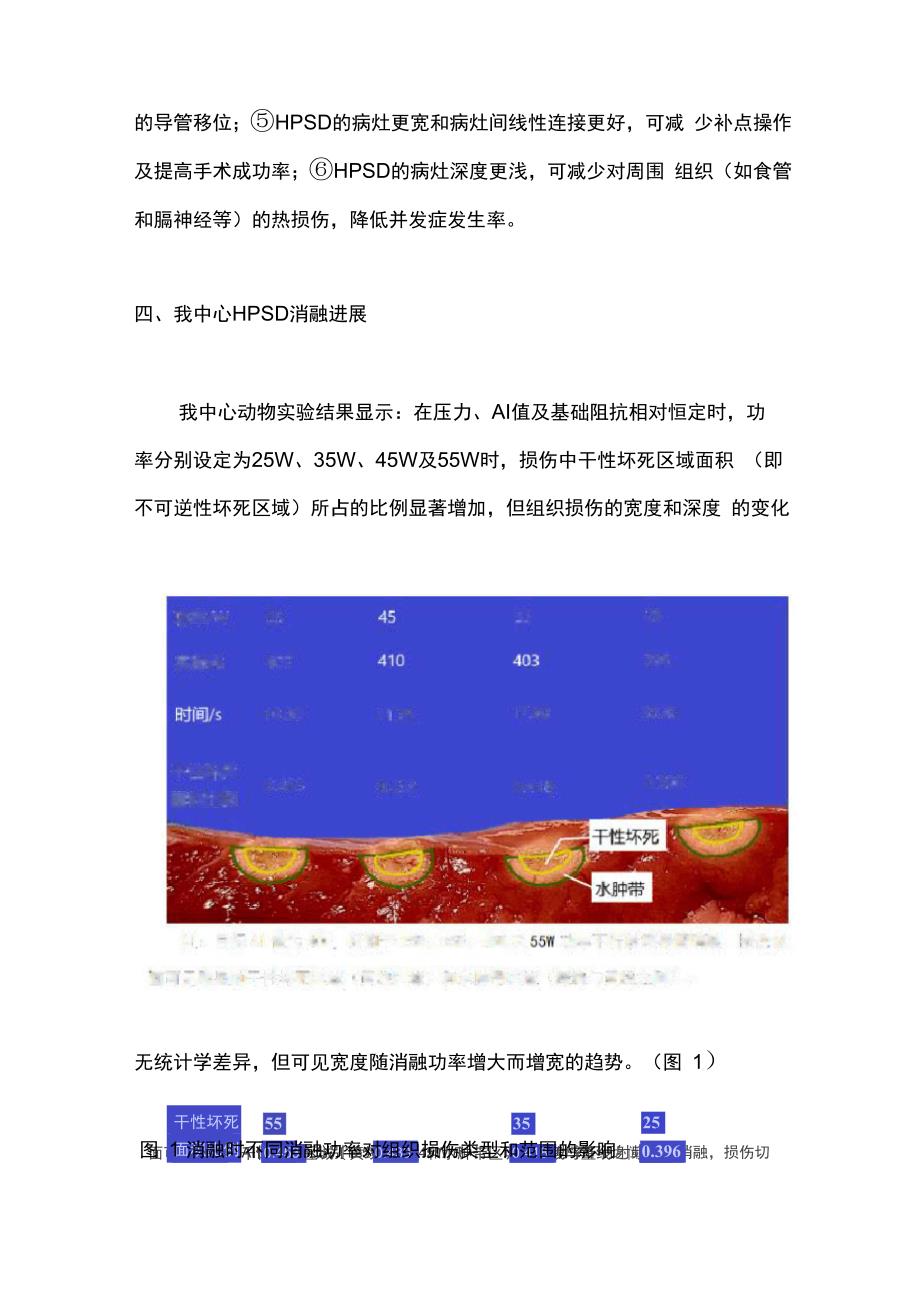 心房颤动的高效消融治疗进展(全文)_第4页