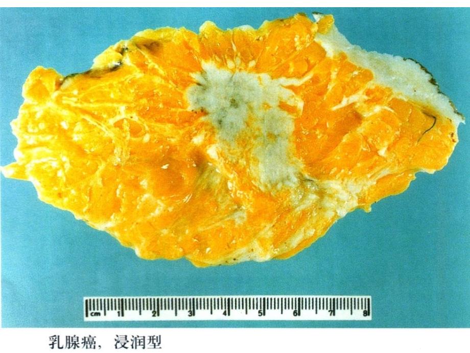 肿瘤生化与分子生物学基础_第3页