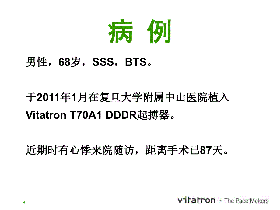 数字化起搏器在房颤诊治中的优势_第4页