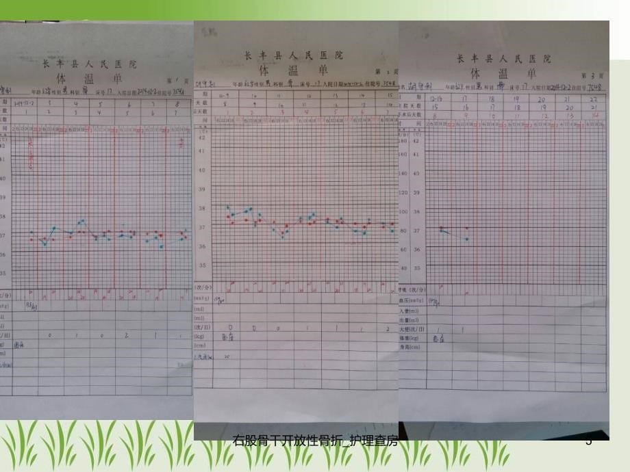 右股骨干开放性骨折护理查房课件_第5页