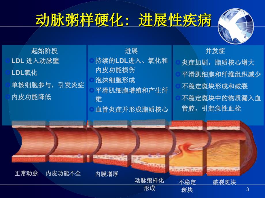 心肌梗死PPT幻灯片课件_第3页