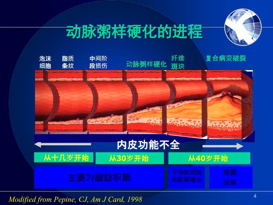 心肌梗死PPT幻灯片课件_第4页