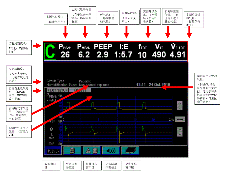 840呼吸机模式参数设定和调节_第4页