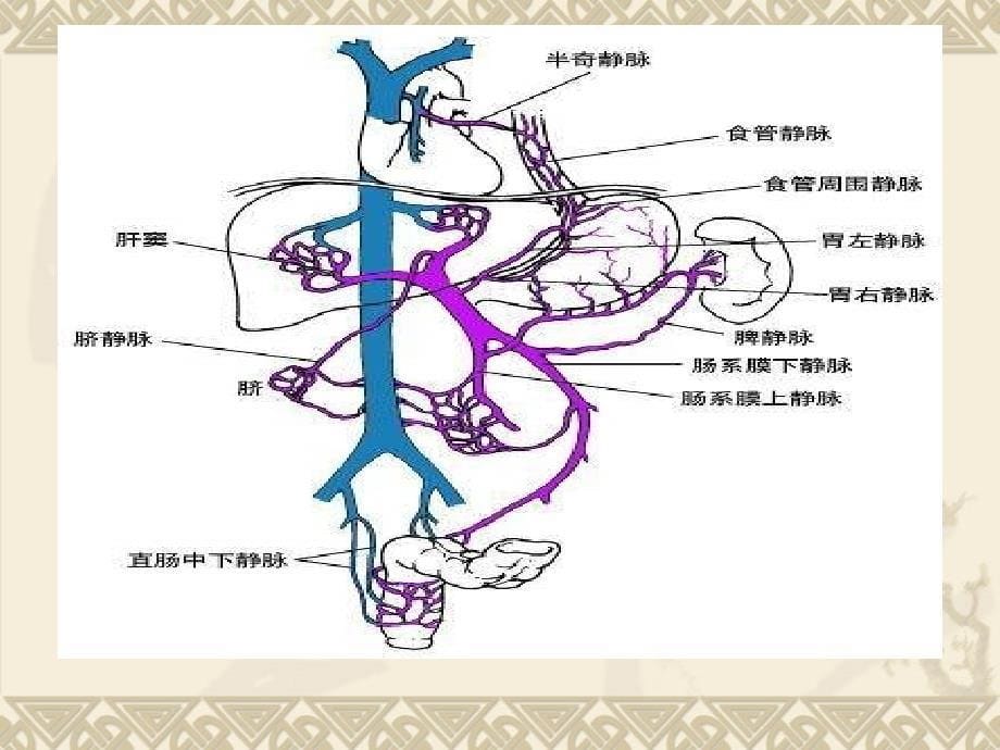 门静脉高压症的手术治疗单纯脾切除_第5页