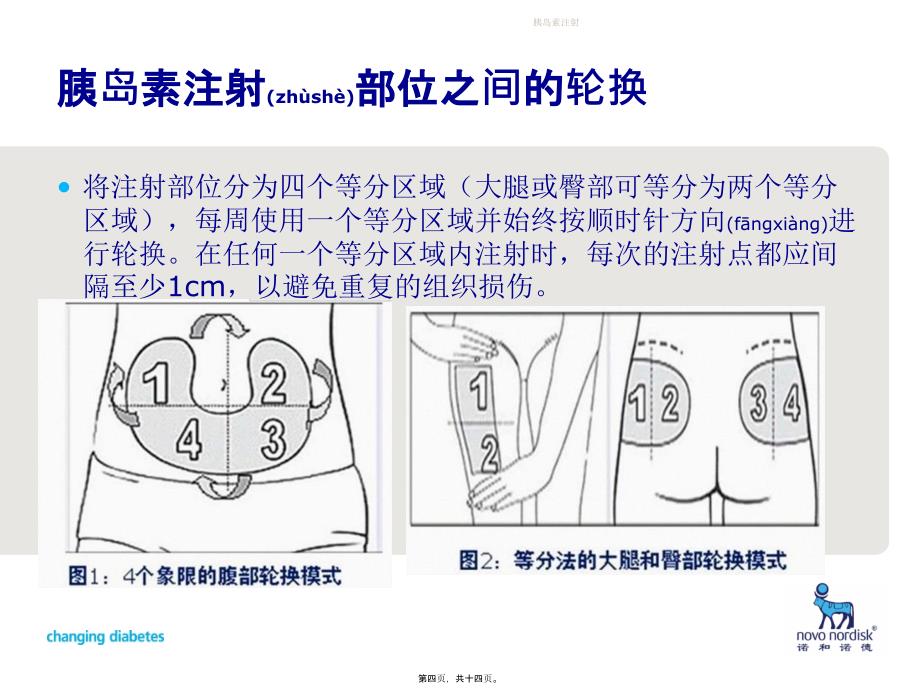 胰岛素注射课件_第4页