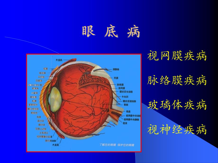 视网膜疾病课件医疗_第2页