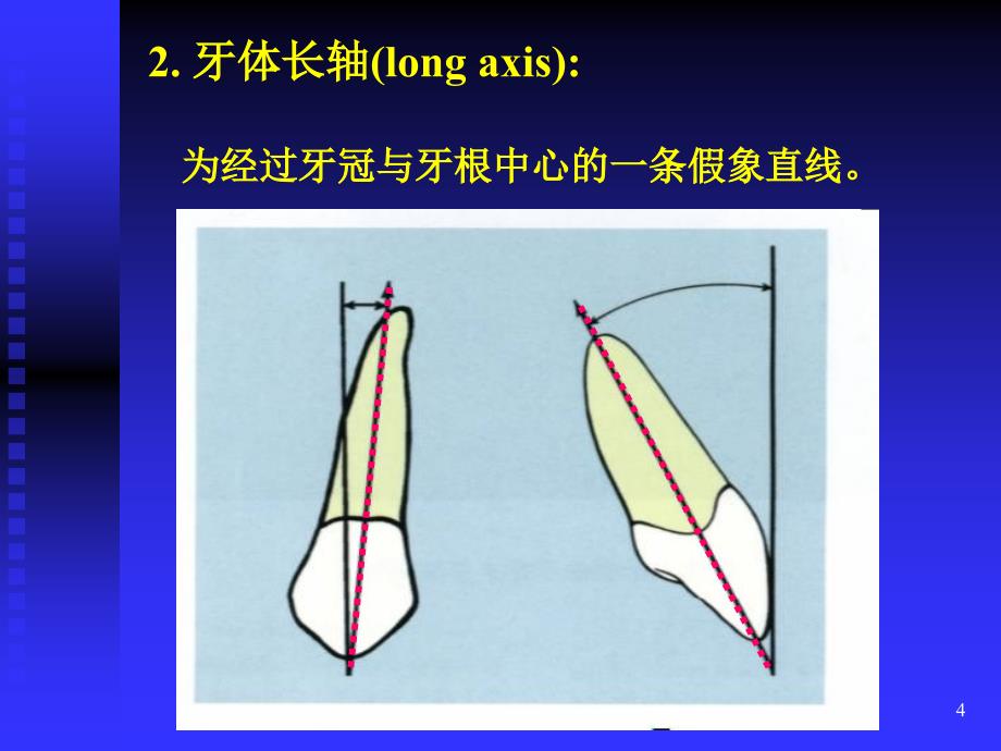 牙解剖标志PowerPoint演示文稿_第4页