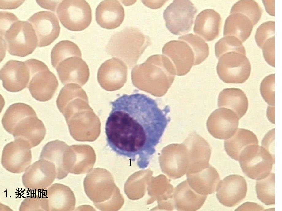医学免疫学血细胞图片小测文档资料_第1页