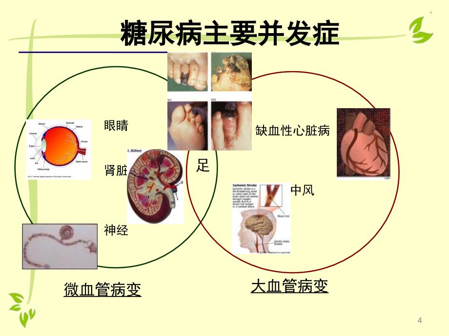 优质课件糖尿病高血压中医健康教育讲座_第3页