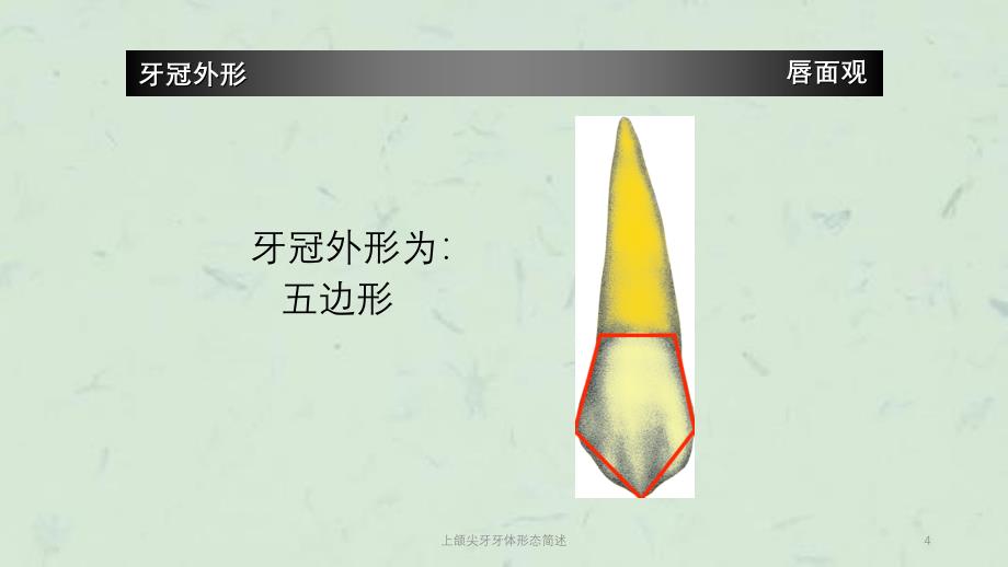 上颌尖牙牙体形态简述课件_第4页