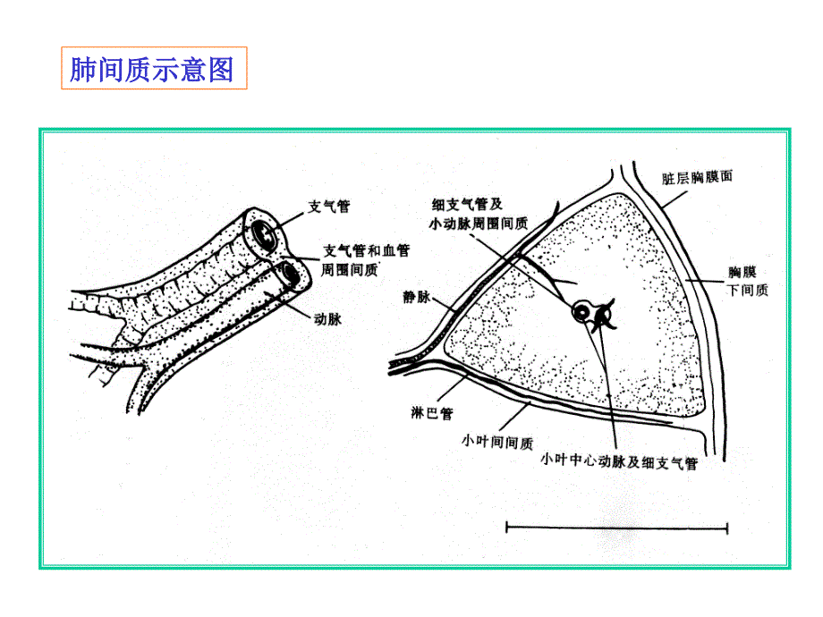 肺间质性病变改_第2页