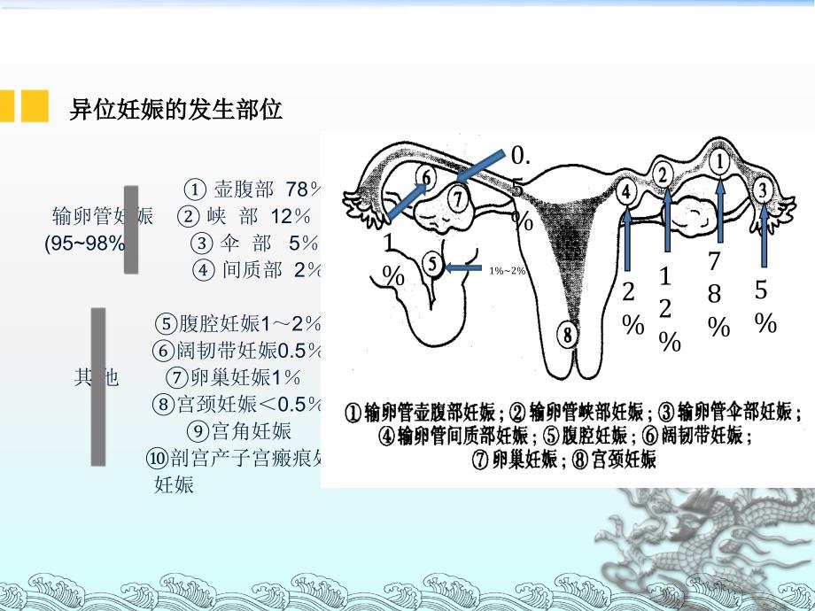 宫外孕的护理查房_第3页